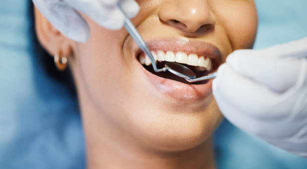 Best Dentist for Tooth Abscess  in Berlin, WI